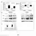 Fig. 07 - Use of lyso-Gb1 as druggable target