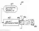 Fig. 01 - Decontamination device and method using ultrasonic cavitation