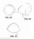 Fig. 06 - BREAST TREATMENT DEVICE