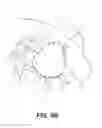 Fig. 10 - BREAST TREATMENT DEVICE