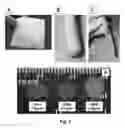 Fig. 03 - Extracellular Matrix-Derived Gels and Related Methods