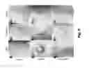 Fig. 07 - Three-Dimensional Tissue Matrix Scaffold System