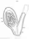 Fig. 01 - Devices and methods for aneurysm treatment
