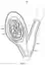 Fig. 02 - Devices and methods for aneurysm treatment