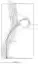 Fig. 03 - Devices and methods for aneurysm treatment