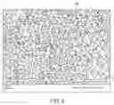 Fig. 07 - Devices and methods for aneurysm treatment