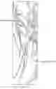 Fig. 16 - Devices and methods for aneurysm treatment