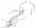 Fig. 01 - DEVICES AND METHODS FOR MANAGING CHEST DRAINAGE