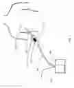 Fig. 02 - DEVICES AND METHODS FOR MANAGING CHEST DRAINAGE