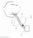 Fig. 03 - DEVICES AND METHODS FOR MANAGING CHEST DRAINAGE