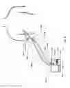 Fig. 04 - DEVICES AND METHODS FOR MANAGING CHEST DRAINAGE
