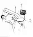 Fig. 26 - DEVICES AND METHODS FOR MANAGING CHEST DRAINAGE