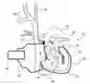Fig. 01 - Circulatory assistance device