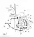 Fig. 05 - Circulatory assistance device