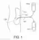 Fig. 02 - SYSTEM AND METHOD FOR ADMINISTERING PERITONEAL DIALYSIS