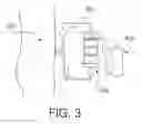 Fig. 04 - SYSTEM AND METHOD FOR ADMINISTERING PERITONEAL DIALYSIS
