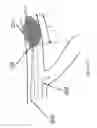 Fig. 07 - Systems and methods for providing zones of selective thermal therapy
