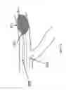 Fig. 08 - Systems and methods for providing zones of selective thermal therapy