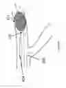 Fig. 09 - Systems and methods for providing zones of selective thermal therapy