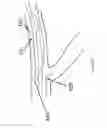 Fig. 11 - Systems and methods for providing zones of selective thermal therapy