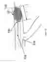 Fig. 15 - Systems and methods for providing zones of selective thermal therapy