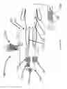 Fig. 21 - Systems and methods for providing zones of selective thermal therapy