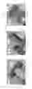 Fig. 09 - Device for subcutaneous delivery of fluid medicament