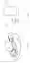 Fig. 21 - Device for subcutaneous delivery of fluid medicament