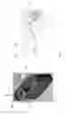 Fig. 26 - Device for subcutaneous delivery of fluid medicament