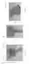 Fig. 27 - Device for subcutaneous delivery of fluid medicament