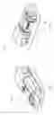 Fig. 45 - Device for subcutaneous delivery of fluid medicament