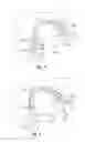Fig. 04 - LARYNGEAL MASK ASSEMBLY