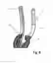 Fig. 07 - LARYNGEAL MASK ASSEMBLY
