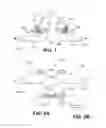 Fig. 02 - RESPIRATORY ASSISTANCE DEVICE AND SYSTEM AND METHOD