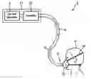 Fig. 01 - System and method for operating a pump in a humidifier