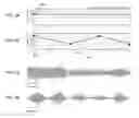 Fig. 03 - Method to increase quality of sleep with acoustic intervention