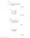 Fig. 03 - Support devices for bodily fluid transfer systems and methods of using the same
