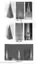 Fig. 07 - ELECTROMOLDED MICRONEEDLES AND FABRICATION METHODS THEREOF