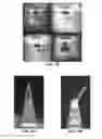 Fig. 10 - ELECTROMOLDED MICRONEEDLES AND FABRICATION METHODS THEREOF