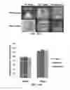 Fig. 12 - ELECTROMOLDED MICRONEEDLES AND FABRICATION METHODS THEREOF