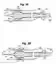 Fig. 05 - Devices, systems and methods for enhancing intraluminal drug delivery and uptake