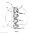 Fig. 03 - Percutaneous ports with wire coils