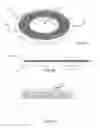 Fig. 04 - Percutaneous ports with wire coils