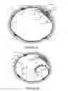 Fig. 06 - Transvascular nerve stimulation apparatus and methods