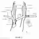 Fig. 17 - Transvascular nerve stimulation apparatus and methods