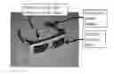 Fig. 01 - Retina prosthesis