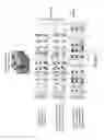 Fig. 10 - Retina prosthesis