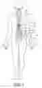 Fig. 02 - Implantable device with optical lead