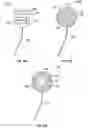 Fig. 05 - SYSTEM, DEVICE, AND METHOD FOR CROSS-LINKING CORNEAL TISSUE