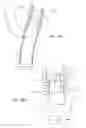 Fig. 13 - INTRA-ORAL LIGHT-THERAPY APPARATUSES AND METHODS FOR THEIR USE